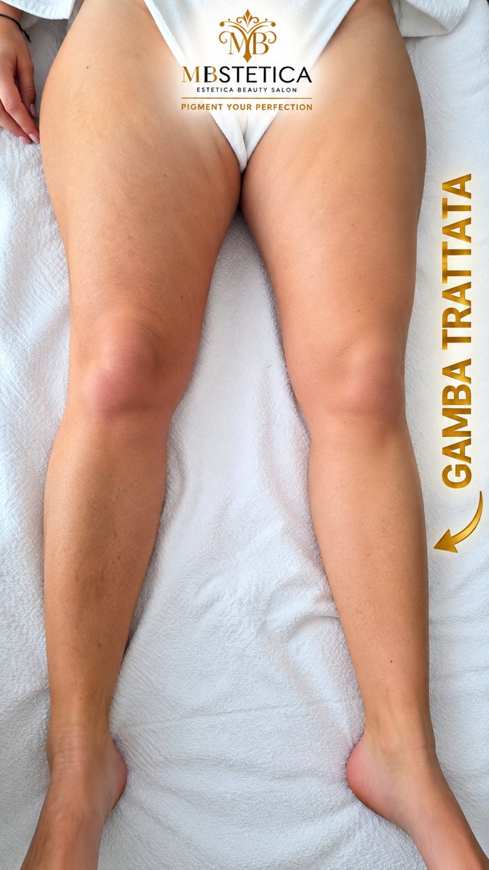 Massaggio rimodellante Genova: gamba trattata e gamba non trattata dopo una seduta